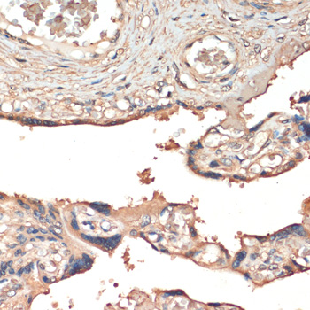 a01069 mst1 primary antiboties ihc testing 2