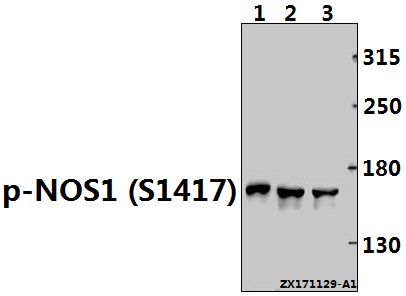Western blot (WB) analysis of p-NOS1 (S1417) pAb at 1:500 dilution
Lane1:PC3 whole cell lysate(40ug)
Lane2:U-87MG whole cell lysate(40ug)
Lane3:HEK293T whole cell lysate(40ug)