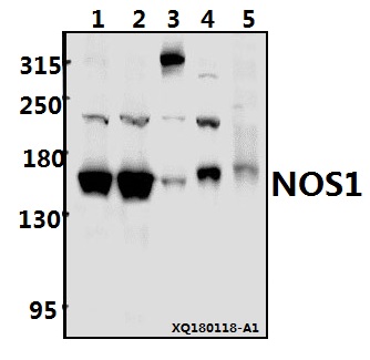 Western blot (WB) analysis of NOS1 (Y846) pAb at 1:500 dilution
Lane1:PC3 whole cell lysate(40ug)
Lane2:A549 whole cell lysate(40ug)
Lane3:U-87MG whole cell lysate(20ug)
Lane4:C6 whole cell lysate(40ug)
Lane5:BV2 whole cell lysate(40ug)