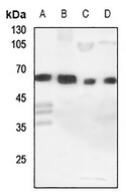 Western blot analysis of CYP11A1 expression in HEK293T (A), Hela (B), H460 (C), mouse lung (D) whole cell lysates