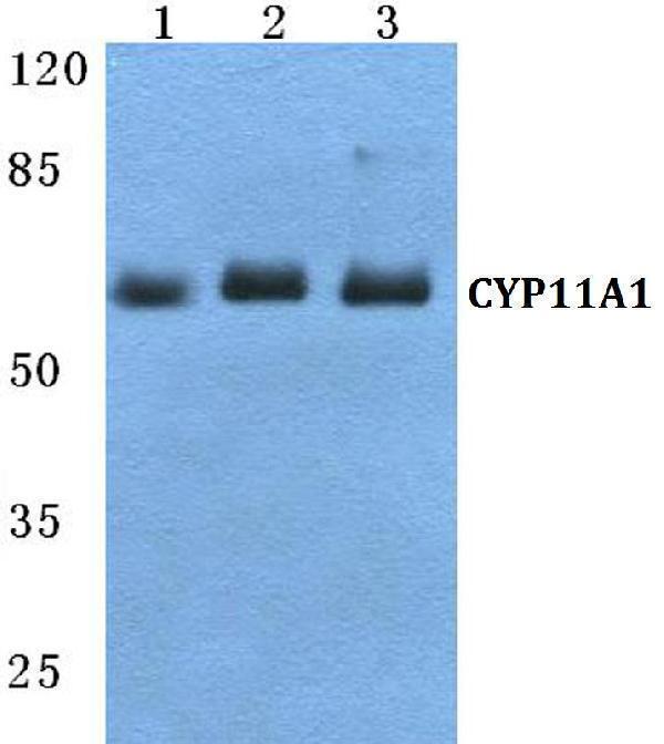 Western blot (WB) analysis of CYP11A1 polyclonal antibody at 1:500 dilution
Lane1:Jurkat cell lysate
Lane2:Mouse liver tissue lysate
Lane3:Rat liver tissue lysate