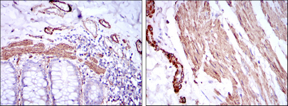Immunohistochemistry analysis of paraffin-embedded human duodenum tissues (left) and human esophagus tissues (right) with DAB staining using ACTA2 Monoclonal Antibody