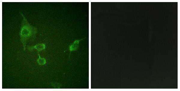 Immunofluorescence analysis of HepG2 cells, using HCK Antibody