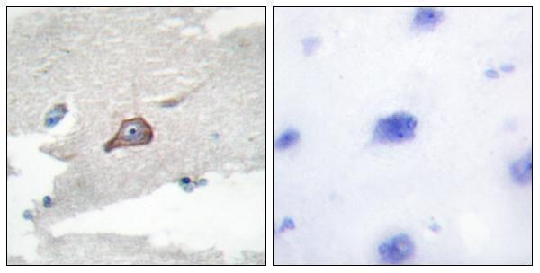 Immunohistochemistry analysis of paraffin-embedded human brain tissue, using HCK Antibody 