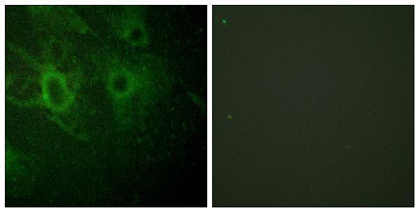 Immunofluorescence analysis of HeLa cells, using HCK (Phospho-Tyr410) Antibody