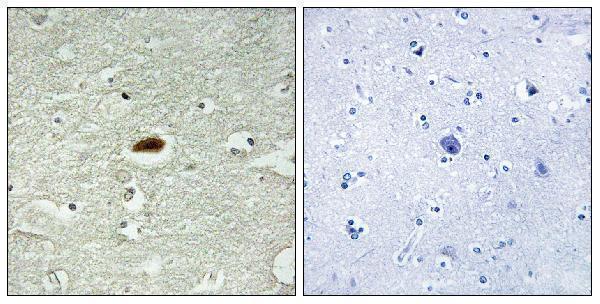 Immunohistochemistry analysis of paraffin-embedded human brain tissue, using Period Circadian Protein 2 Antibody