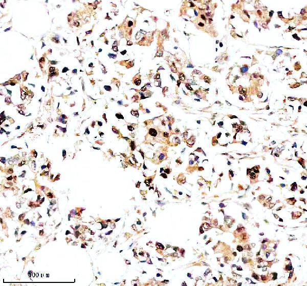 IHC analysis of NR1D1 using anti-NR1D1 antibody (A01077-2)