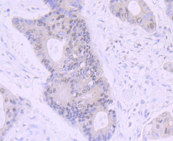 a01077 nr1d1 primary antiboties ihc testing 2