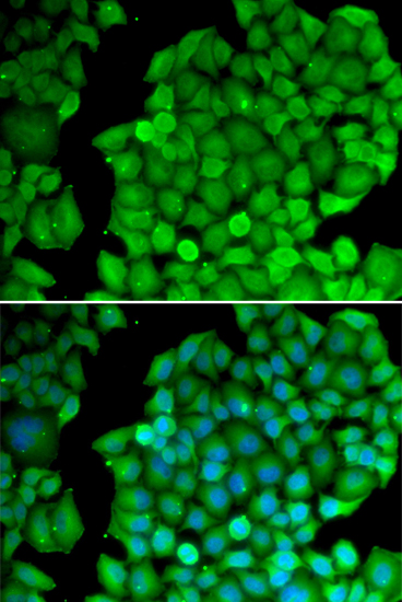 Immunofluorescence analysis of U2OS cells using Cyclin D2 antibody 