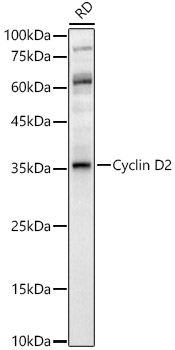 Western blot analysis of RD, using Cyclin D2 antibody  at  1:500 dilution