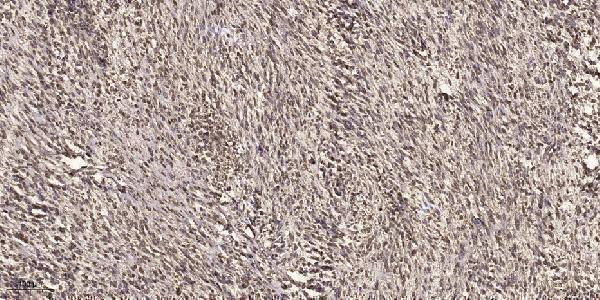 a01079t280 ccnd2 primary antibodies ihc testing 1