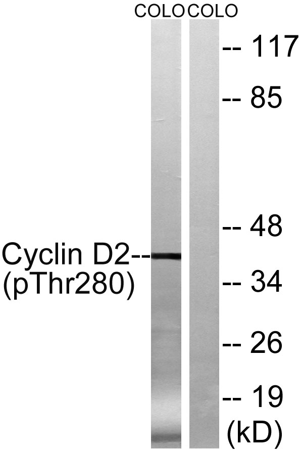 a01079t280 ccnd2 primary antibodies wb testing 2