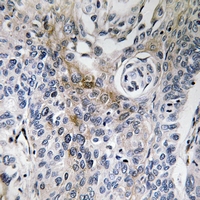 a01080 cd63 primary antiboties ihc testing 2