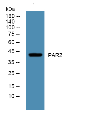 Western blot analysis of lysates from A431 cells, primary antibody was diluted at 1:1000, 4°over night