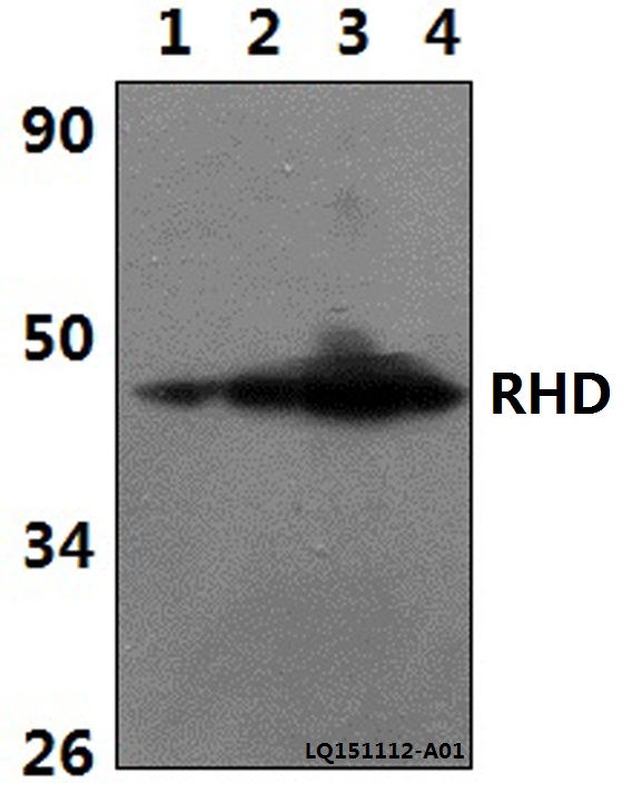 Western blot (WB) analysis of RHD polyclonal antibody at 1:500 dilution
Lane1:The Brain tissue lysate of Rat(30ug)
Lane2:The Brain tissue lysate of Mouse(30ug)
Lane3:HEK293T whole cell lysate(40ug)
Lane4:H9C2 whole cell lysate(40ug)