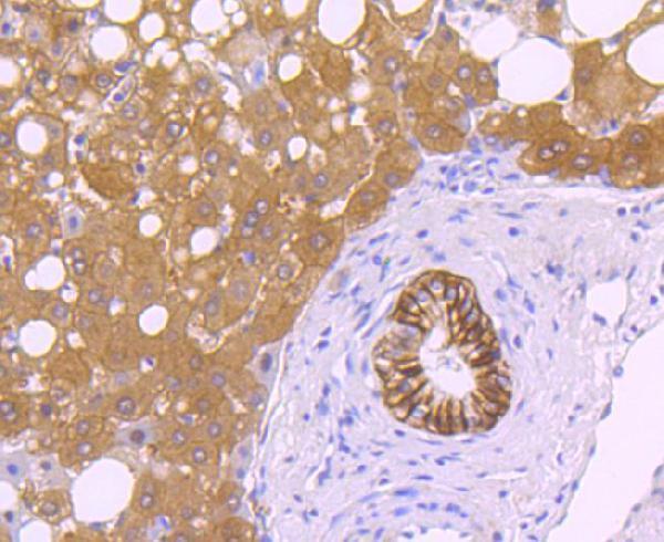 a01083 2 ca9 primary antiboties ihc testing 2