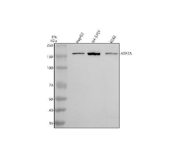  Western blot analysis of ATP7A using anti-ATP7A antibody (A01085-1)