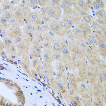 Immunohistochemistry of paraffin-embedded human liver using IL5 antibody at dilution of 1:100 (40x lens)