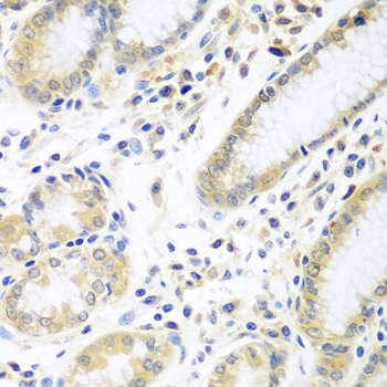 Immunohistochemistry of paraffin-embedded human stomach using IL5 antibody at dilution of 1:100 (40x lens)
