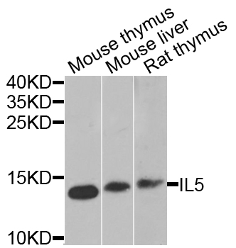 Western blot analysis of extracts of various cell lines, using IL5 antibody