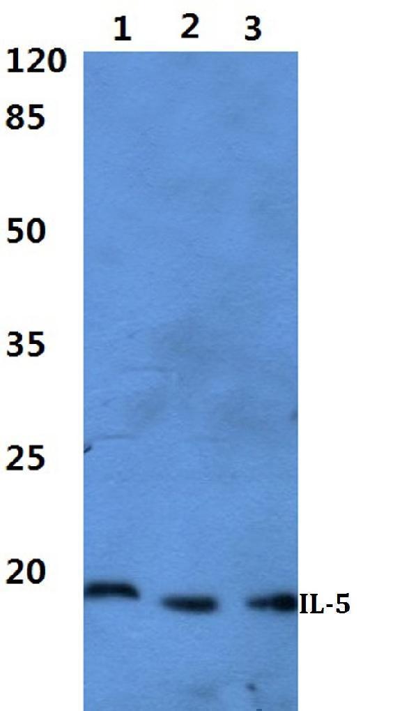 a01086 il5 primary antiboties wb testing 1_1