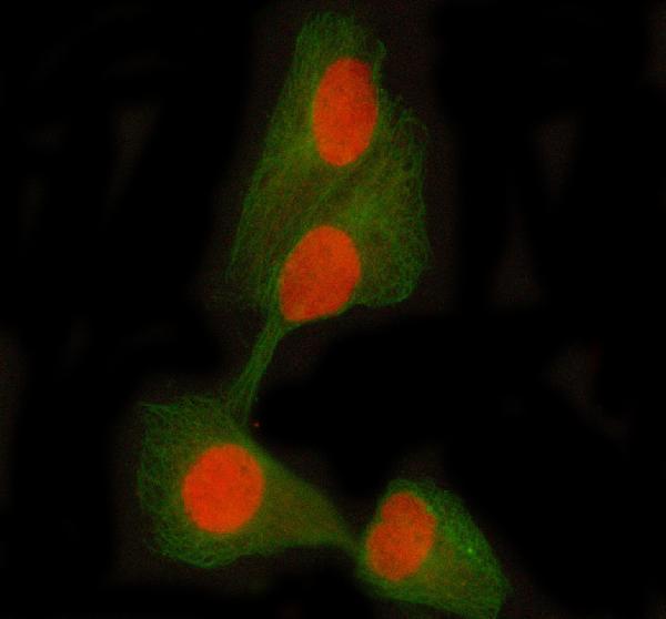 a01087 2 stat5ab primary antibodies if testing 2