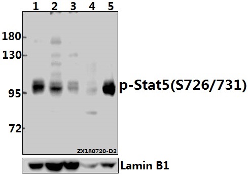 a01087s726 stat5a primary antiboties wb testing 1