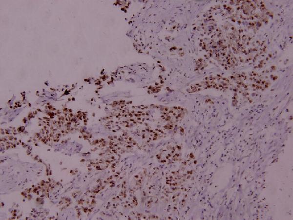 a01087s780 stat5a primary antiboties ihc testing 2