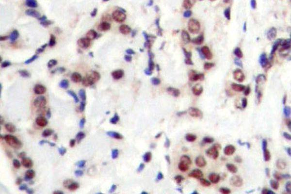 a01087y694 stat5a primary antiboties ihc testing 2