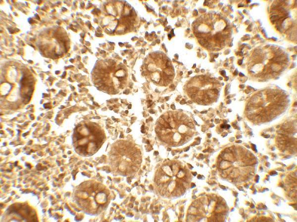 a01088 apobec3b primary antibodies ihc testing 2