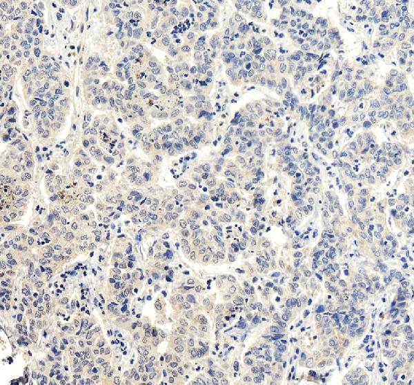 a01089 rbp4 primary antibodies ihc testing 6