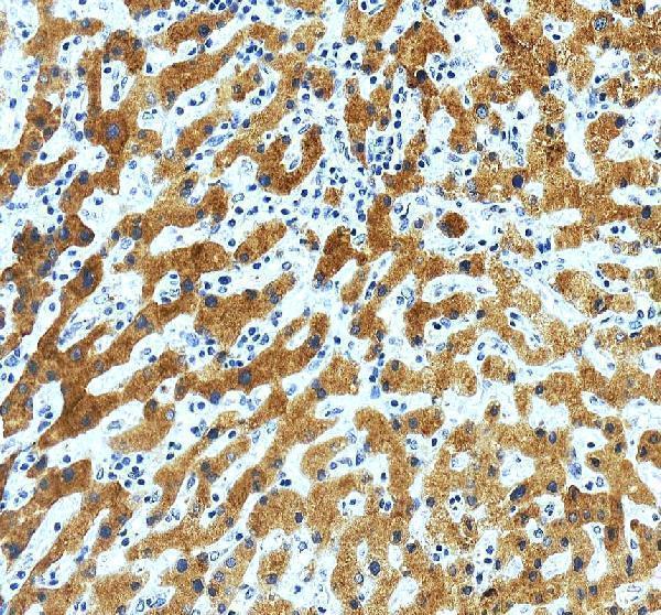 a01089 rbp4 primary antibodies ihc testing 7