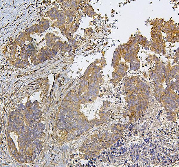 IHC analysis of SDHB using anti-SDHB antibody (A01090)