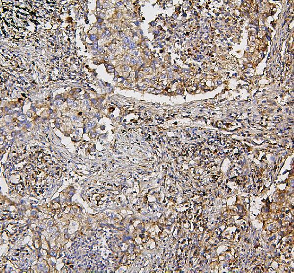 IHC analysis of SDHB using anti-SDHB antibody (A01090)