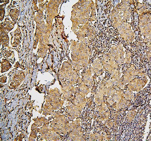 a01090 sdhb primary antibodies ihc testing 3_1