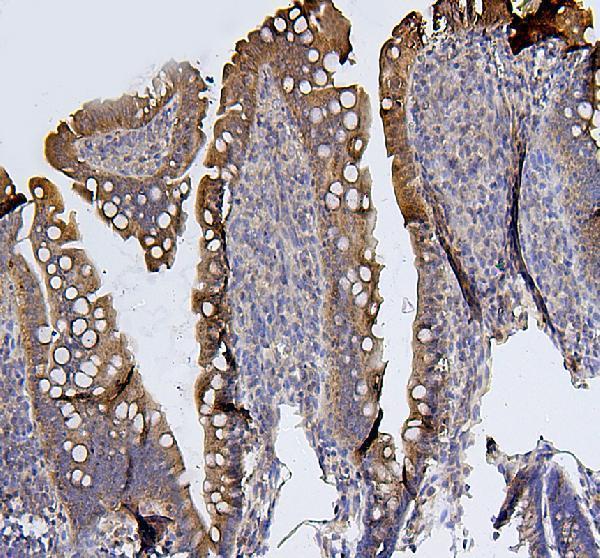 a01090 sdhb primary antibodies ihc testing 5