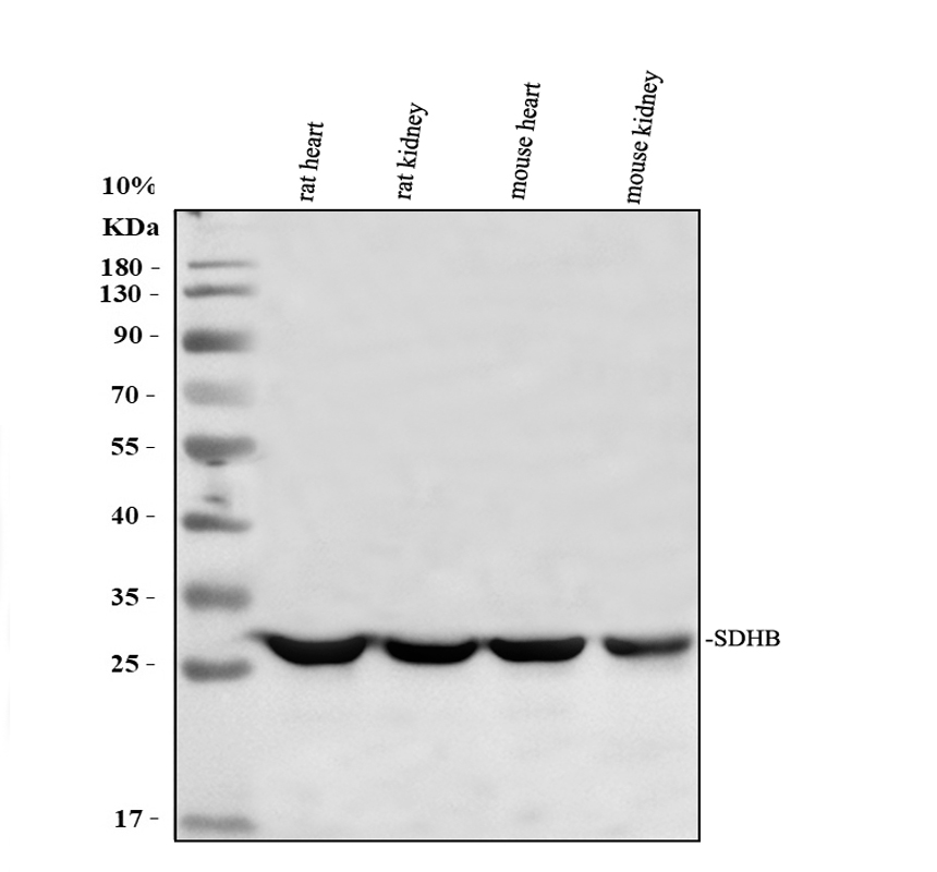 Western blot analysis of SDHB using anti-SDHB antibody (A01090)