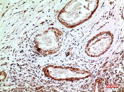 a01092 1 il1r1 primary antibodies ihc testing 1
