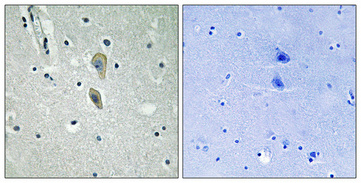 a01092y496 il1r1 primary antibodies ihc testing 1