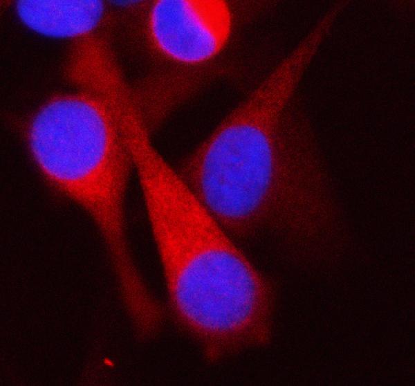 IF analysis of SCARB1 using anti-SCARB1 antibody (A01093-1)
