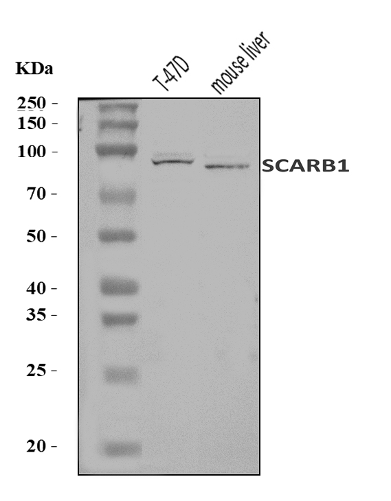  Western blot analysis of Scavenging Receptor SR-BI/SCARB1 using anti-Scavenging Receptor SR-BI/SCARB1 antibody (A01093-1)