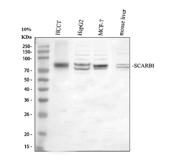 Western blot analysis of SCARB1 using anti-SCARB1 antibody (A01093-1)