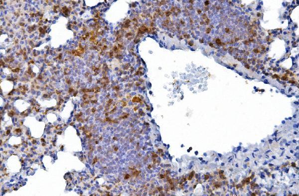  IHC analysis of CD226 using anti-CD226 antibody (A01094-2)