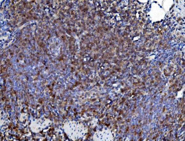  IHC analysis of CD226 using anti-CD226 antibody (A01094-2)