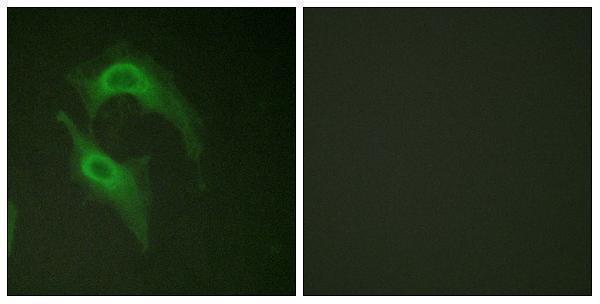Immunofluorescence analysis of HeLa cells, using CD226/DNAM-1 Antibody