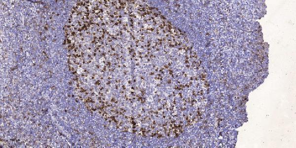 a01094 cd226 primary antibodies ihc testing 5