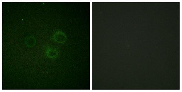 a01094s329 cd226 primary antibodies if testing 5