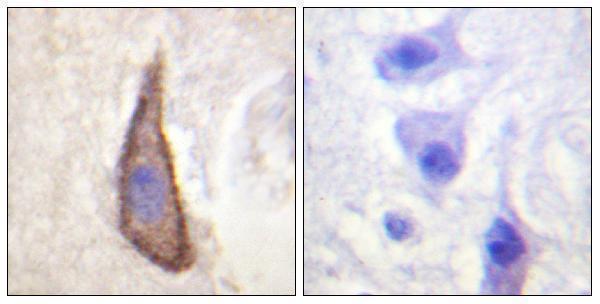 Immunohistochemistry analysis of paraffin-embedded human brain, using CD226/DNAM-1 (Phospho-Ser329) Antibody