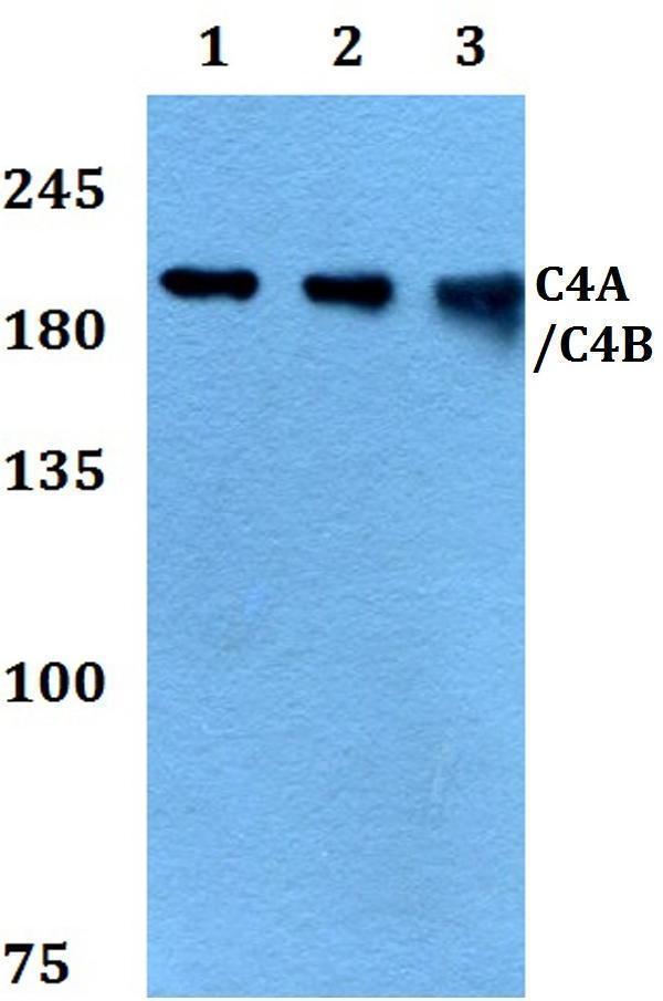 Western blot (WB) analysis of C4A/C4B polyclonal antibody at 1:500 dilution
Lane1:A549 whole cell lysate
Lane2:Raw264