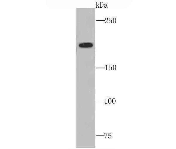 Western blot analysis of C4 on human liver tissue lysate using anti-C4 antibody at 1/1,000 dilution